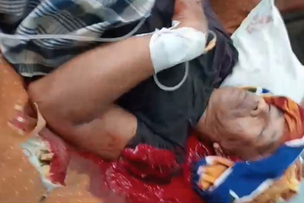 Mantan Kades Patah Parang Inhil Bacok Kepala Seorang PNS