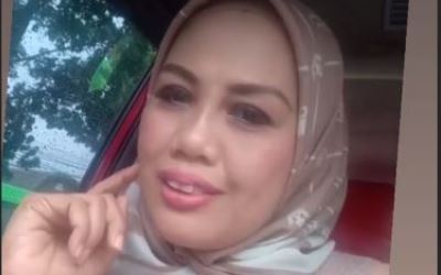 Lelah Jadi Bahan Olokan, Elly Sugigi Potong Giginya