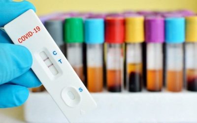 DPR Desak Pemerintah Batasi Harga Jual Rapid Test 