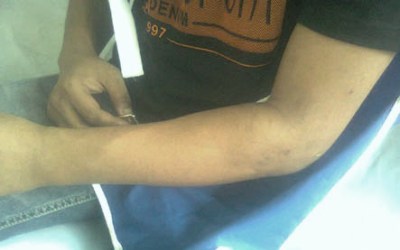 Diduga Dianiaya, Tahanan Lapas Laporkan Sipir