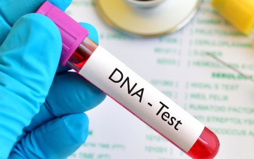 Tes DNA juga Bisa Prediksi Resiko Penyakit 