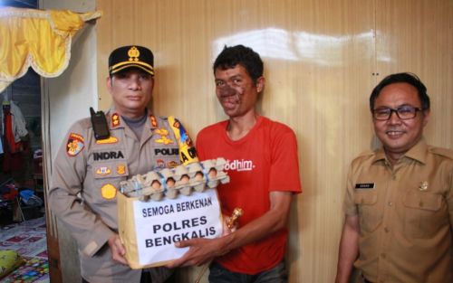 Kapolres Bengkalis Bantu Penderita Penyakit Kanker Kulit Berobat