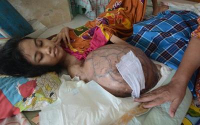 Nurul Penderita Kanker Ganas Perlu Bantuan