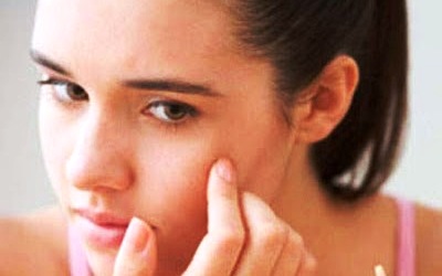 Tips Mengatasi Kulit Kering Pada Wajah