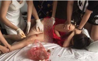 Istri Bubuhi Cabe Kemaluan Selingkuhan Suami