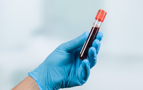 Ini Yang Perlu Dilakukan Usai Sembuh Covid-19 