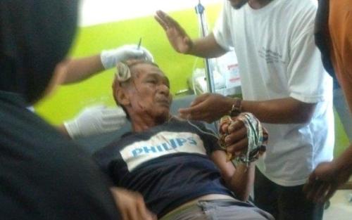 Menginap di Kebun, 3 Orang Petani Diterkam Harimau, 2 Kritis