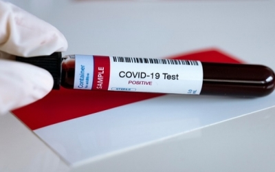 Lagi, Belasan Buruh Rokok di Tulungagung Diduga Positif Corona