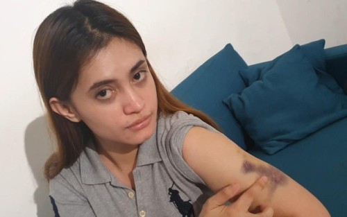 Wanita Disekap-Dipukuli Polwan di Pekanbaru Kaget Dipolisikan Balik