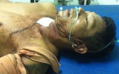 Pulang Mudik, Bahar Pane Langsung Dibacok Tetangga