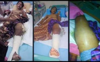 Khairul Yasin, Penderita Tumor Ganas di Bengkalis Berharap Bantuan