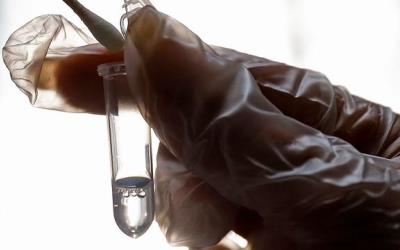 Bea Cukai Tunggu Pemerintah Terkait Impor Alkes Corona