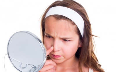 Makanan Ini Dapat Menimbulkan Jerawat Bandel