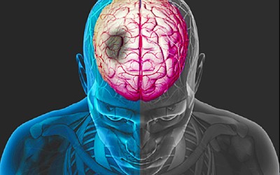 Hindari Empat Bahan Makanan Sehari-hari Perusak Otak