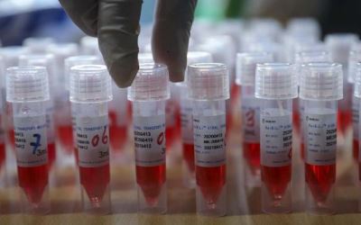 Eijkman Ungkap Perjalanan Virus Corona dari China ke RI