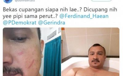 Ferdinand Akui Video Mesra Bersama Pacarnya AL