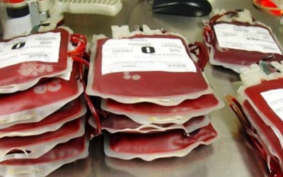 Penderita Thalasemia Kota Langsa Butuh Darah