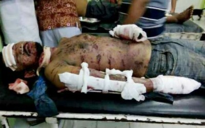 Bom Rakitan Meledak di Lapas Lhokseumawe, 3 Napi Terluka