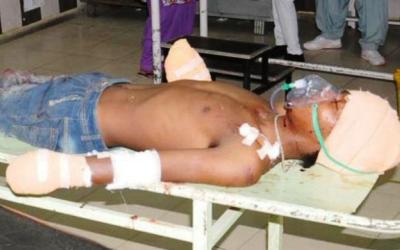 Kedua Tangan Pelaku Pemerkosaan Dipotong Orang Tua Korban